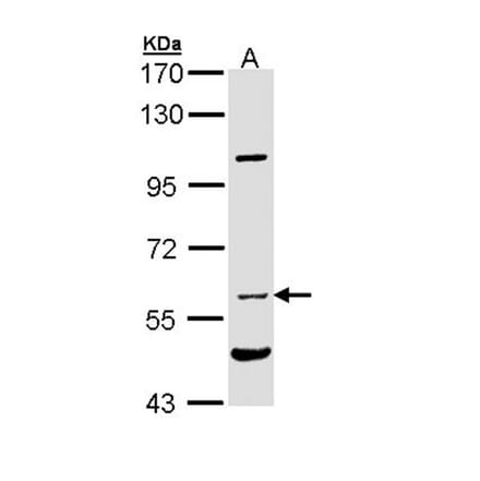 NPR-C antibody from Signalway Antibody (22809) - Antibodies.com