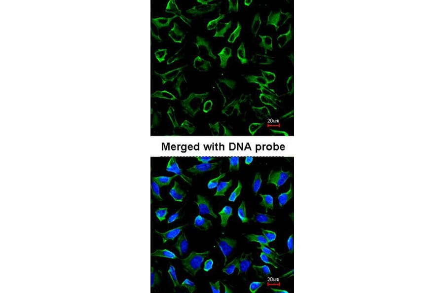 Immunofluorescence - NPR-C antibody from Signalway Antibody (22809) - Antibodies.com