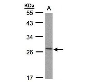 IL-1ra antibody from Signalway Antibody (22895) - Antibodies.com