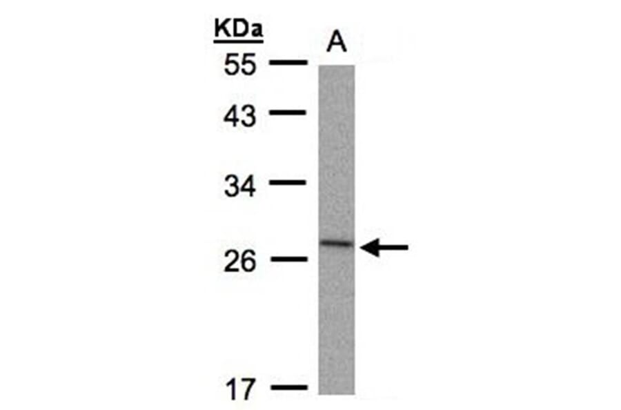 IL-1ra antibody from Signalway Antibody (22895) - Antibodies.com
