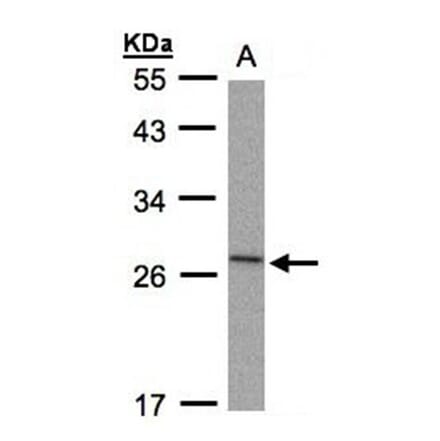 IL-1ra antibody from Signalway Antibody (22895) - Antibodies.com