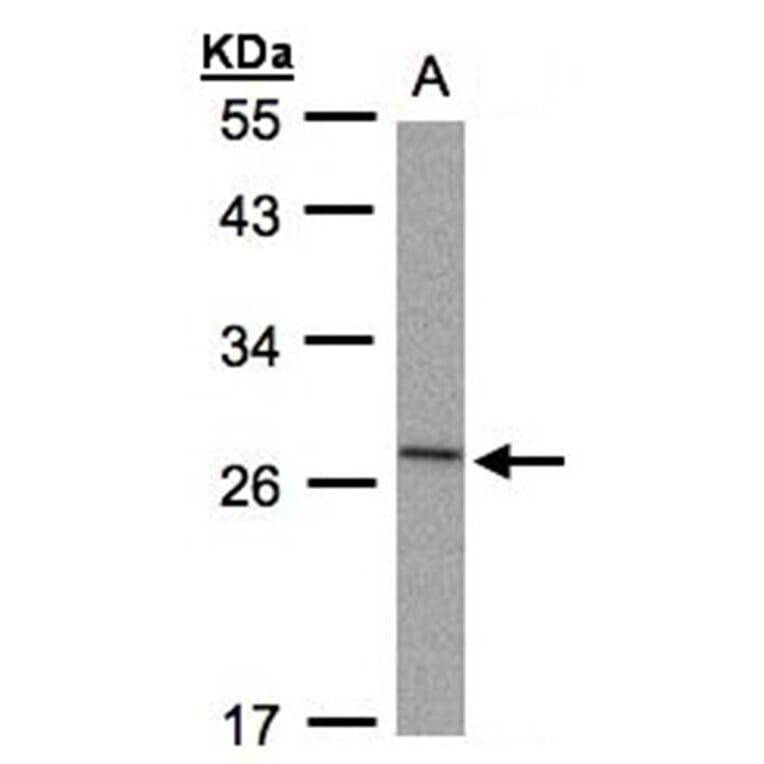 IL-1ra antibody from Signalway Antibody (22895) - Antibodies.com