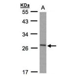 IL-1ra antibody from Signalway Antibody (22895) - Antibodies.com