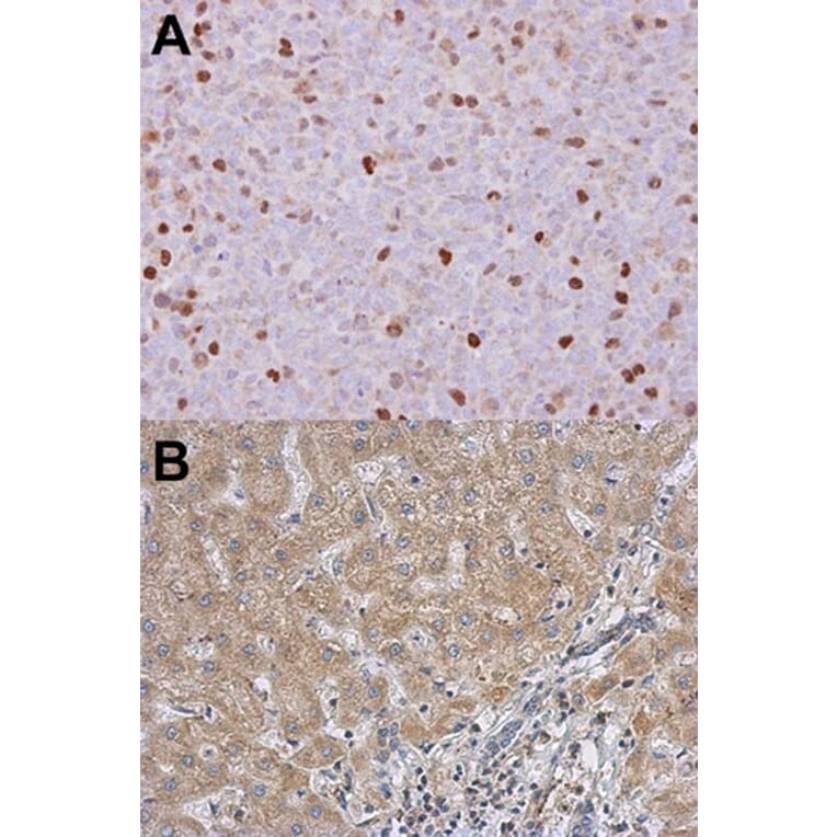 Immunohistochemistry - RACGAP1 antibody from Signalway Antibody (22905) - Antibodies.com