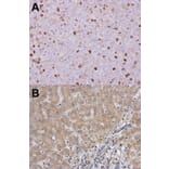 Immunohistochemistry - RACGAP1 antibody from Signalway Antibody (22905) - Antibodies.com
