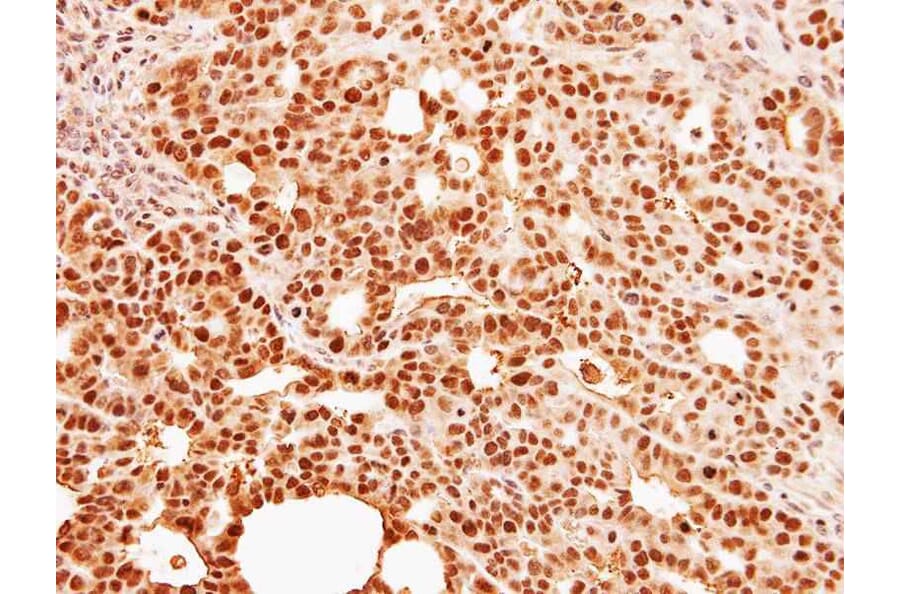 Immunohistochemistry - C9orf78 antibody from Signalway Antibody (23129) - Antibodies.com