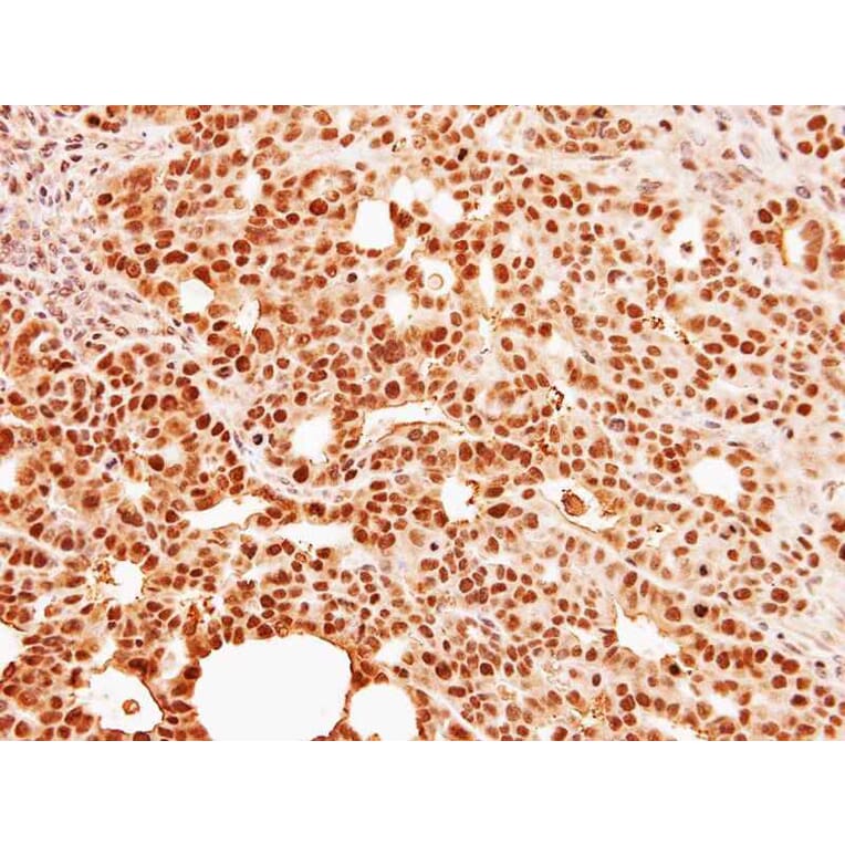 Immunohistochemistry - C9orf78 antibody from Signalway Antibody (23129) - Antibodies.com