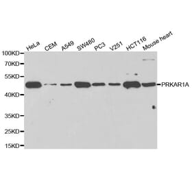 Western blot - PRKAR1A Antibody from Signalway Antibody (32091) - Antibodies.com