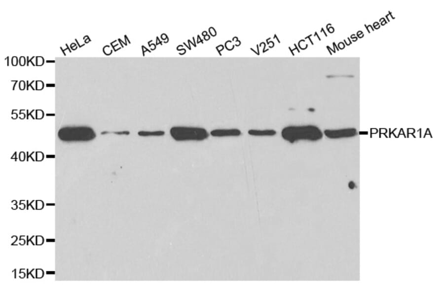 Western blot - PRKAR1A Antibody from Signalway Antibody (32091) - Antibodies.com
