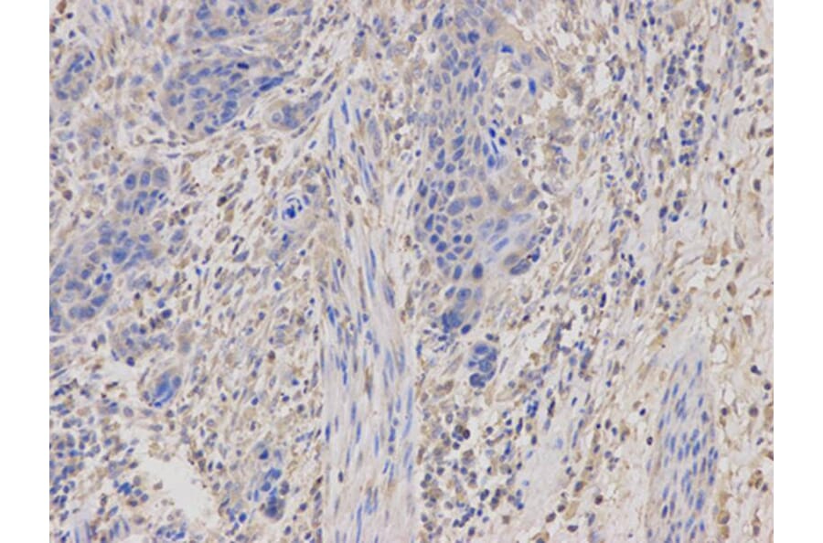 Immunohistochemistry - PRKAR1A Antibody from Signalway Antibody (32091) - Antibodies.com