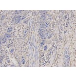 Immunohistochemistry - PRKAR1A Antibody from Signalway Antibody (32091) - Antibodies.com