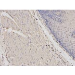 Immunohistochemistry - PRKAR1A Antibody from Signalway Antibody (32091) - Antibodies.com