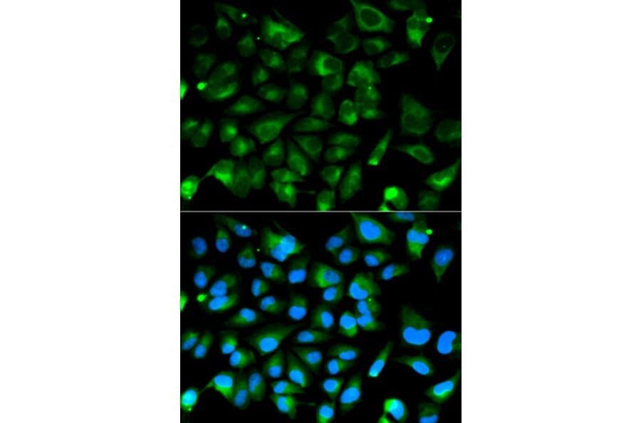 Immunofluorescence - PRKAR1A Antibody from Signalway Antibody (32091) - Antibodies.com