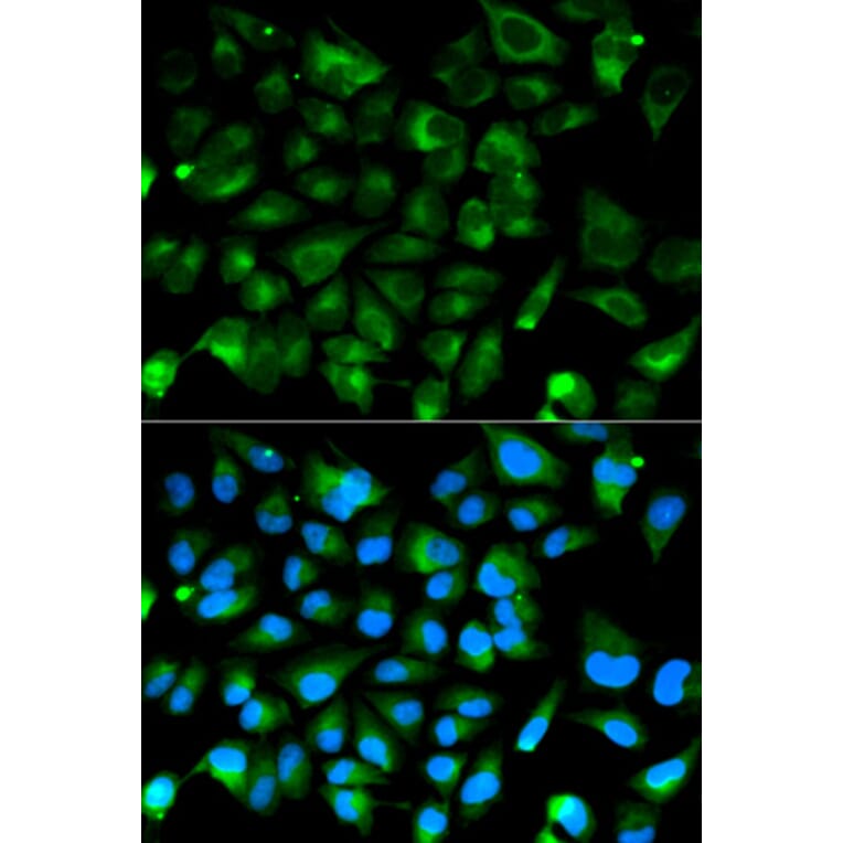 Immunofluorescence - PRKAR1A Antibody from Signalway Antibody (32091) - Antibodies.com
