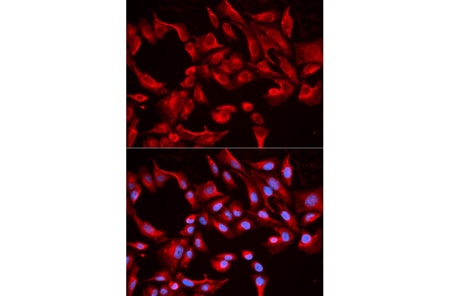 Immunofluorescence - BCL2L13 Antibody from Signalway Antibody (32164) - Antibodies.com