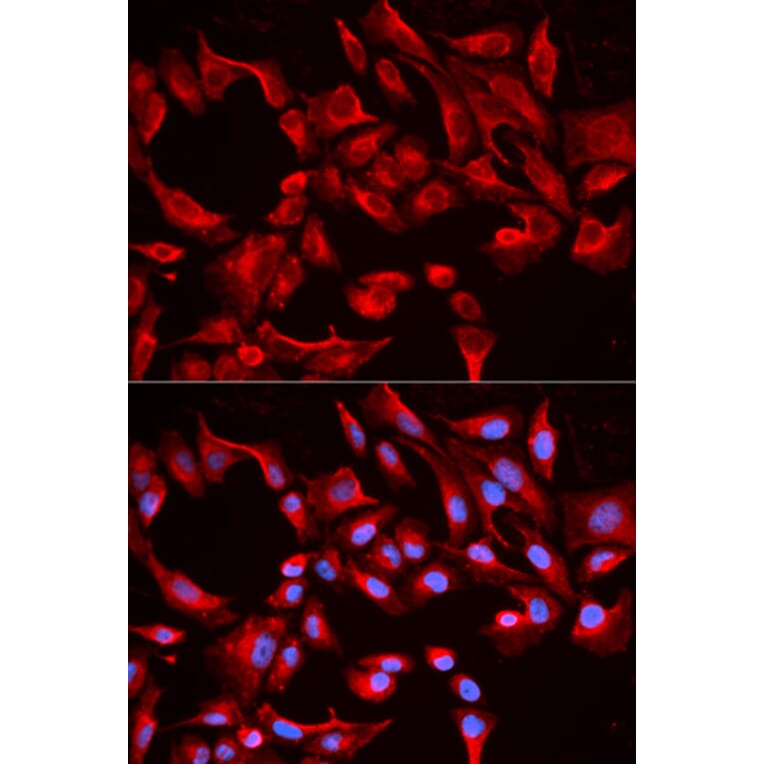 Immunofluorescence - BCL2L13 Antibody from Signalway Antibody (32164) - Antibodies.com