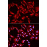 Immunofluorescence - BCL2L13 Antibody from Signalway Antibody (32164) - Antibodies.com