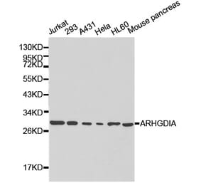 Western blot - ARHGDIA Antibody from Signalway Antibody (32232) - Antibodies.com