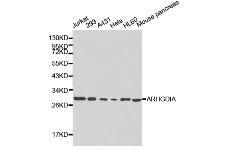 Western blot - ARHGDIA Antibody from Signalway Antibody (32232) - Antibodies.com