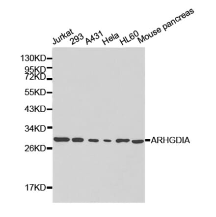 Western blot - ARHGDIA Antibody from Signalway Antibody (32232) - Antibodies.com