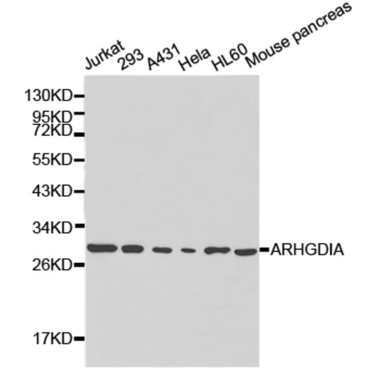 Western blot - ARHGDIA Antibody from Signalway Antibody (32232) - Antibodies.com