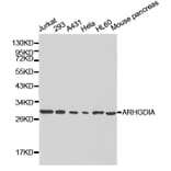 Western blot - ARHGDIA Antibody from Signalway Antibody (32232) - Antibodies.com