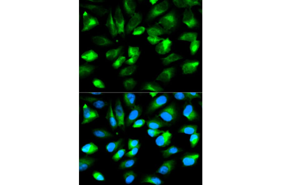 Immunofluorescence - ARHGDIA Antibody from Signalway Antibody (32232) - Antibodies.com