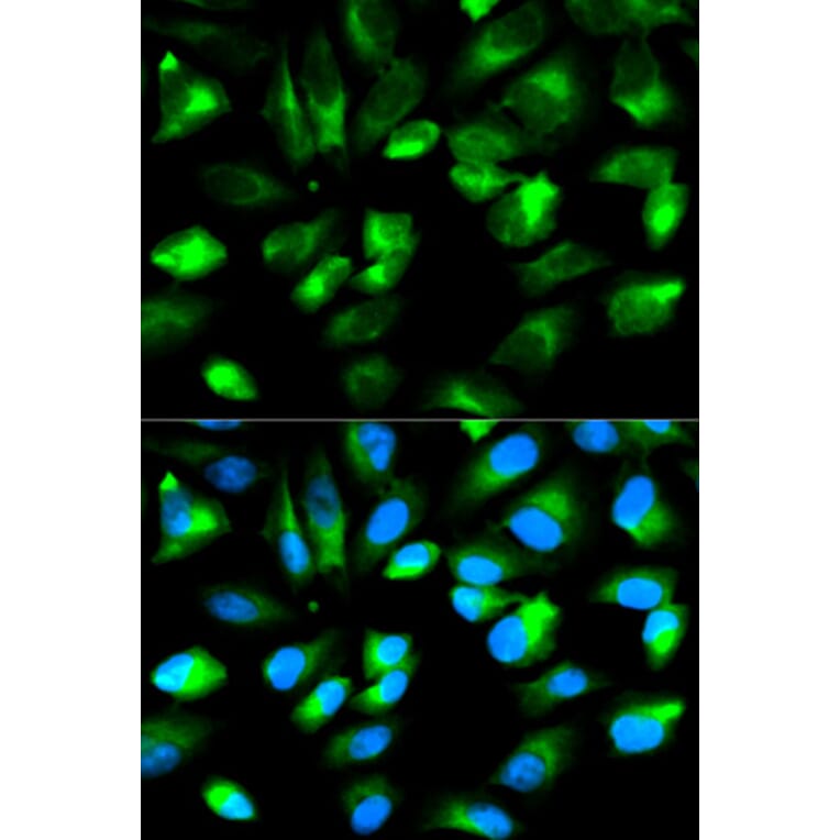 Immunofluorescence - ARHGDIA Antibody from Signalway Antibody (32232) - Antibodies.com