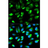 Immunofluorescence - ARHGDIA Antibody from Signalway Antibody (32232) - Antibodies.com