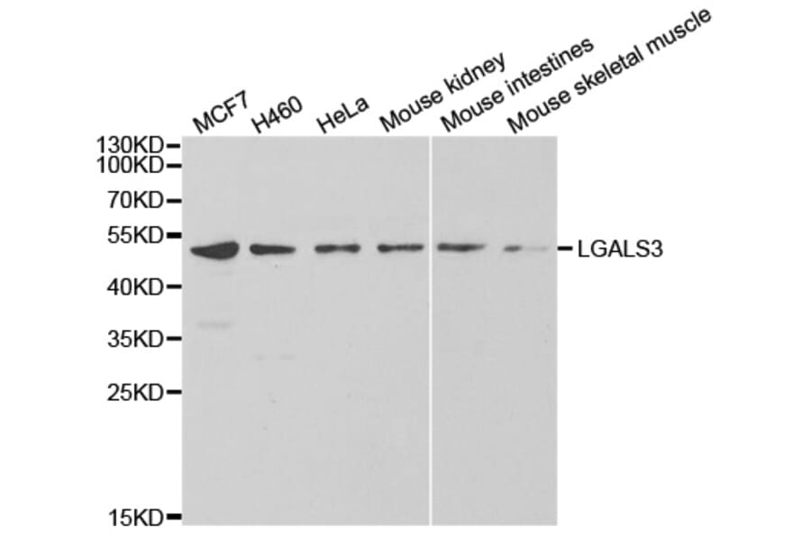 Western blot - eLGALS3 Antibody from Signalway Antibody (32285) - Antibodies.com