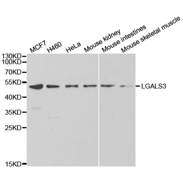 Western blot - eLGALS3 Antibody from Signalway Antibody (32285) - Antibodies.com