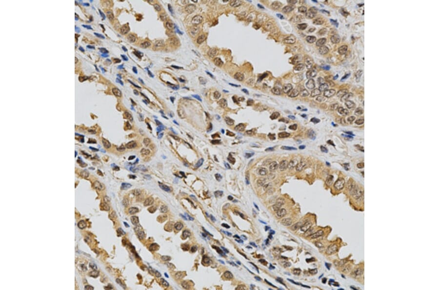 Immunohistochemistry - eLGALS3 Antibody from Signalway Antibody (32285) - Antibodies.com