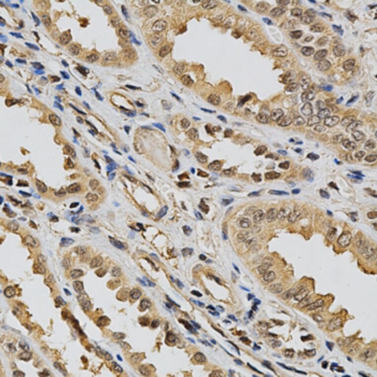 Immunohistochemistry - eLGALS3 Antibody from Signalway Antibody (32285) - Antibodies.com