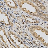 Immunohistochemistry - eLGALS3 Antibody from Signalway Antibody (32285) - Antibodies.com