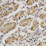 Immunohistochemistry - eLGALS3 Antibody from Signalway Antibody (32285) - Antibodies.com