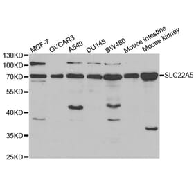 Western blot - SLC22A5 Antibody from Signalway Antibody (32381) - Antibodies.com