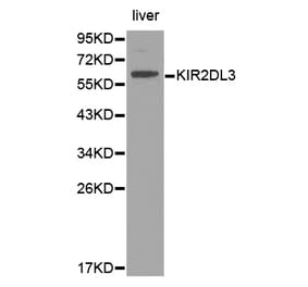 Western blot - KIR2DL3 Antibody from Signalway Antibody (32391) - Antibodies.com