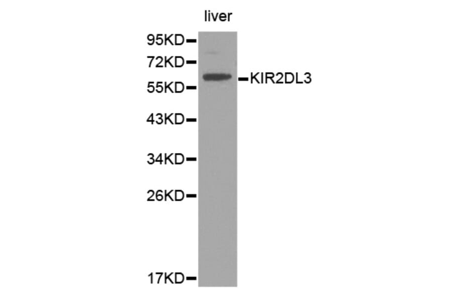 Western blot - KIR2DL3 Antibody from Signalway Antibody (32391) - Antibodies.com