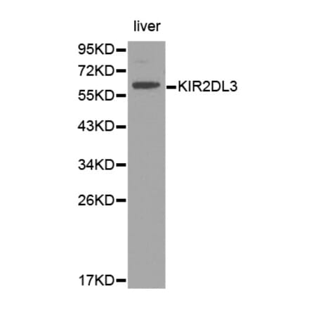 Western blot - KIR2DL3 Antibody from Signalway Antibody (32391) - Antibodies.com