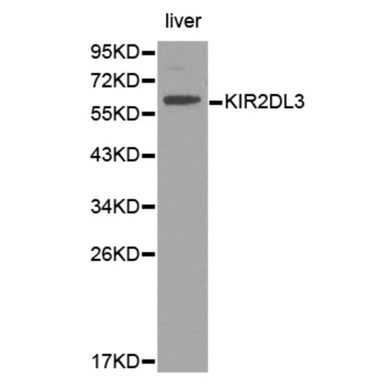 Western blot - KIR2DL3 Antibody from Signalway Antibody (32391) - Antibodies.com