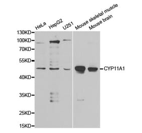 Western blot - CYP11A1 Antibody from Signalway Antibody (32398) - Antibodies.com