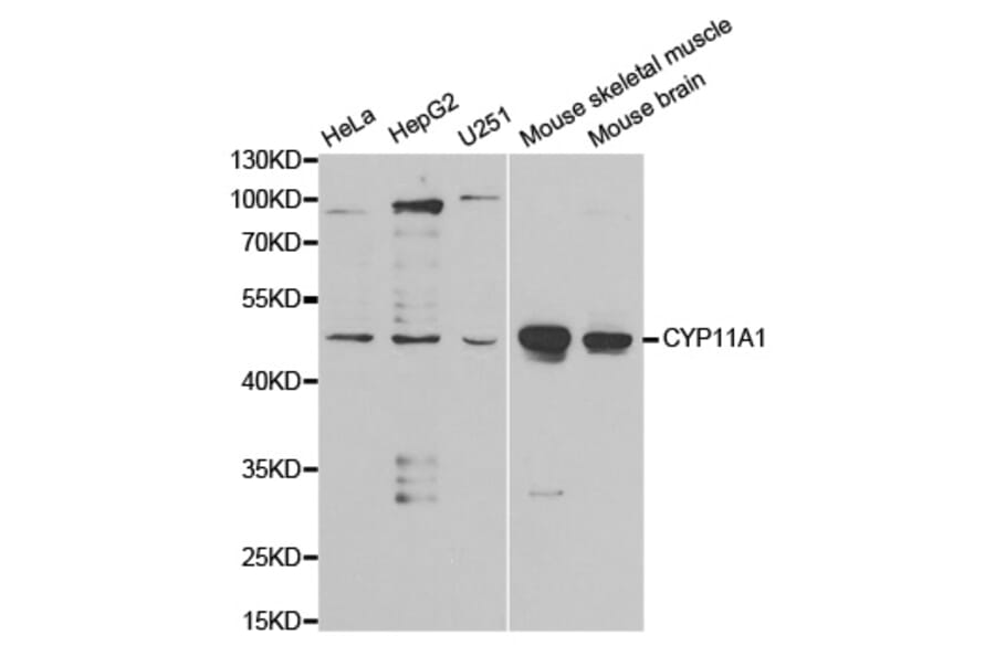Western blot - CYP11A1 Antibody from Signalway Antibody (32398) - Antibodies.com