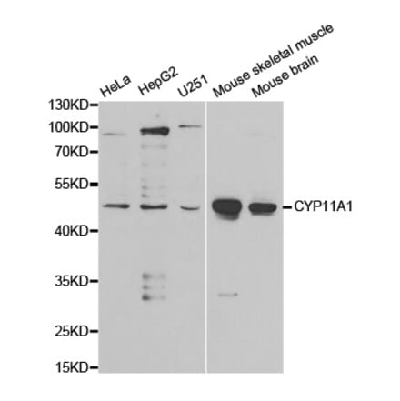 Western blot - CYP11A1 Antibody from Signalway Antibody (32398) - Antibodies.com