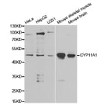 Western blot - CYP11A1 Antibody from Signalway Antibody (32398) - Antibodies.com