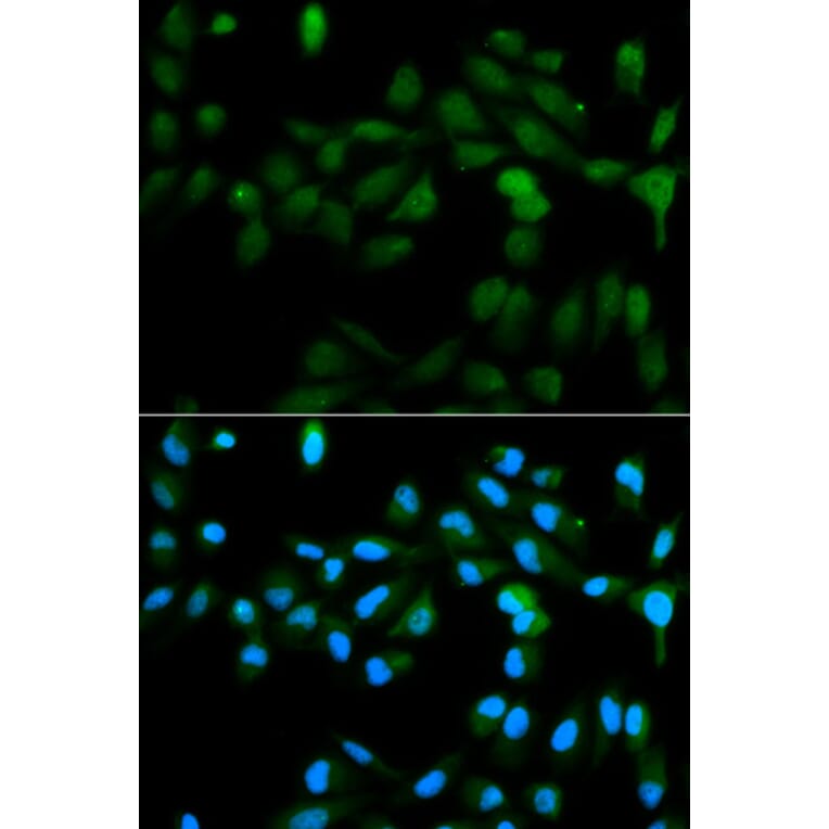 Immunofluorescence - CYP11A1 Antibody from Signalway Antibody (32398) - Antibodies.com