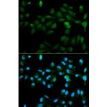 Immunofluorescence - CYP11A1 Antibody from Signalway Antibody (32398) - Antibodies.com