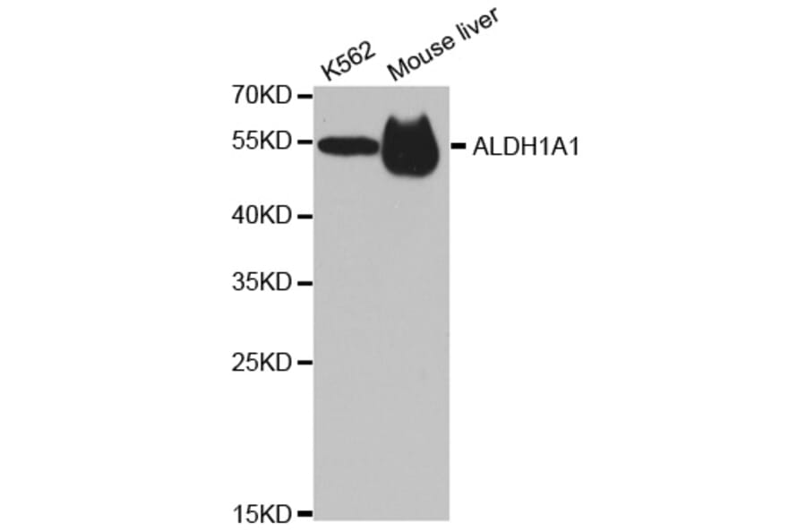 Western blot - ALDH1A1 Antibody from Signalway Antibody (32441) - Antibodies.com
