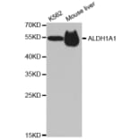 Western blot - ALDH1A1 Antibody from Signalway Antibody (32441) - Antibodies.com