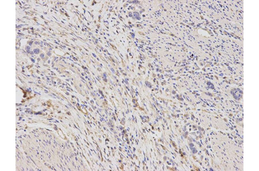Immunohistochemistry - ALDH1A1 Antibody from Signalway Antibody (32441) - Antibodies.com