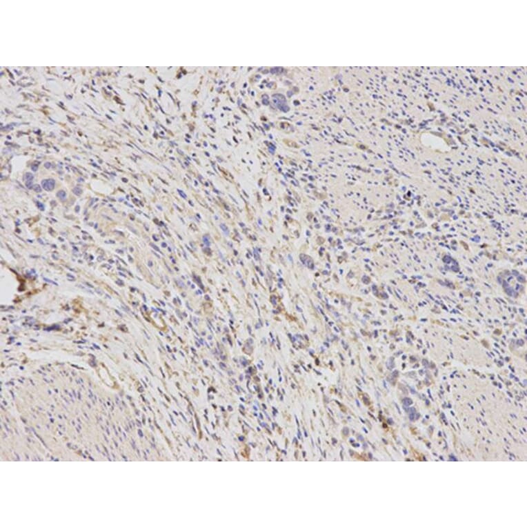 Immunohistochemistry - ALDH1A1 Antibody from Signalway Antibody (32441) - Antibodies.com